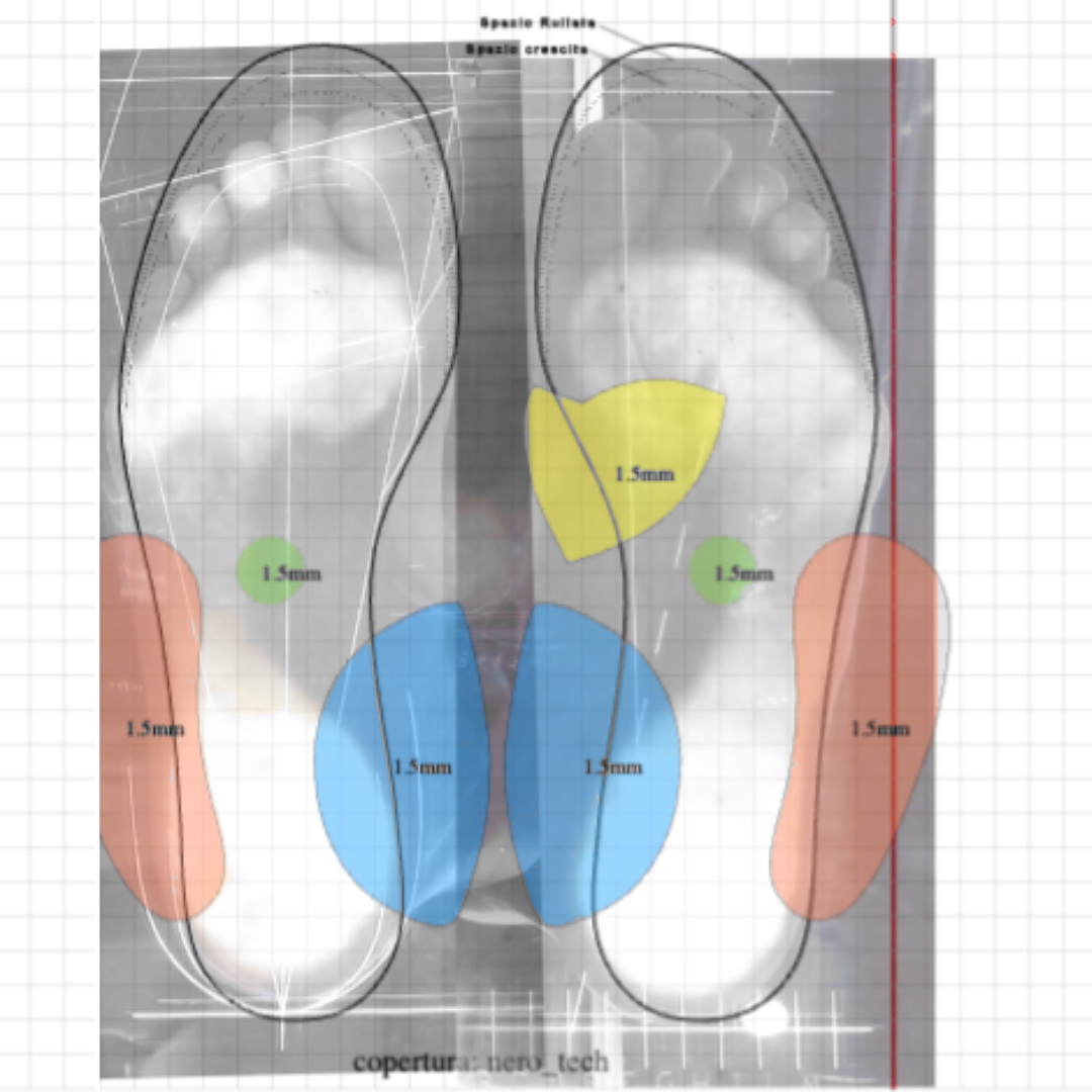 Progettazione Plantare Propriocettivo - Soletta Propriocettiva - Plantare Posturale