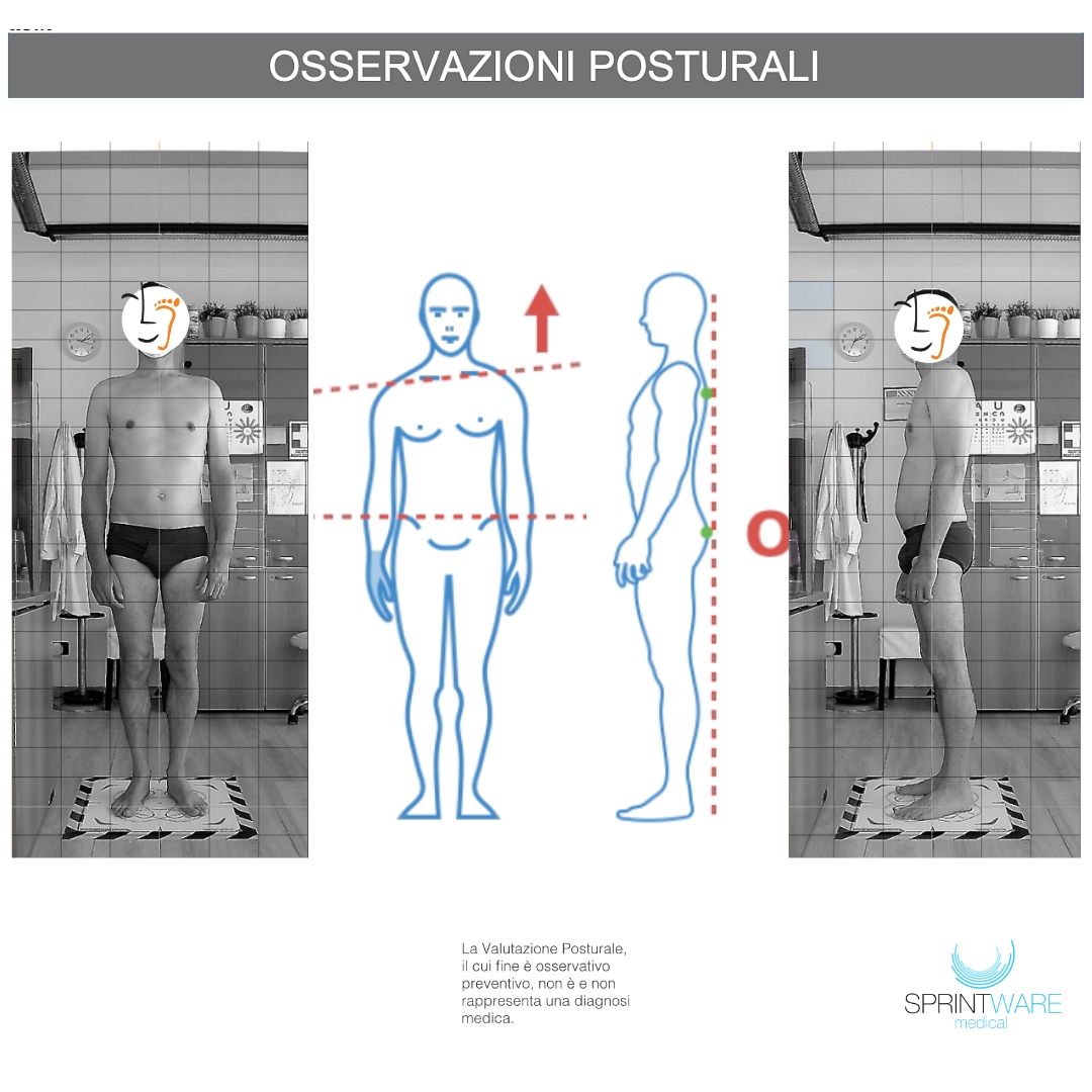 Esame fotografico della Postura